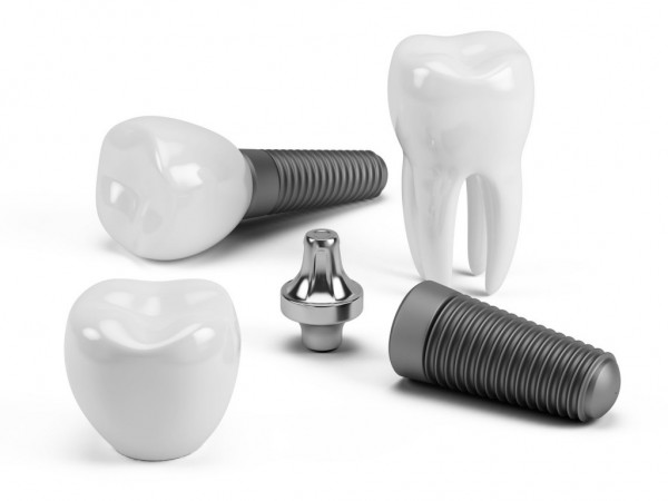 When Dental Implants Are Used
