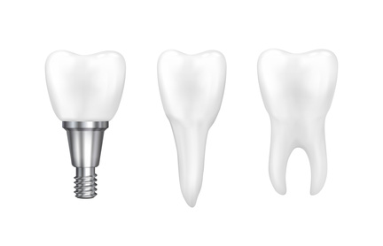 implant diş kliniği
