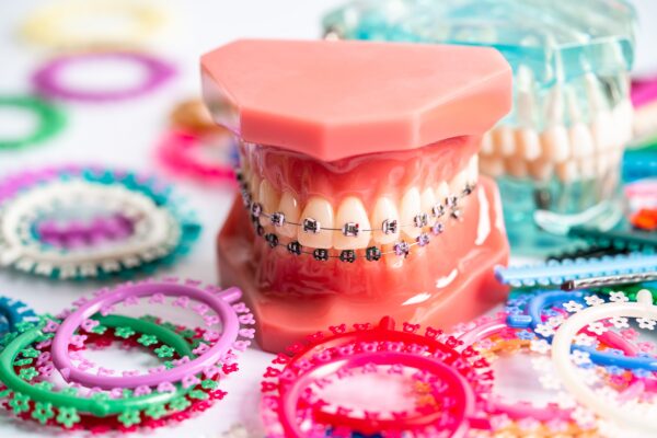 Preventive Orthodontic Treatment