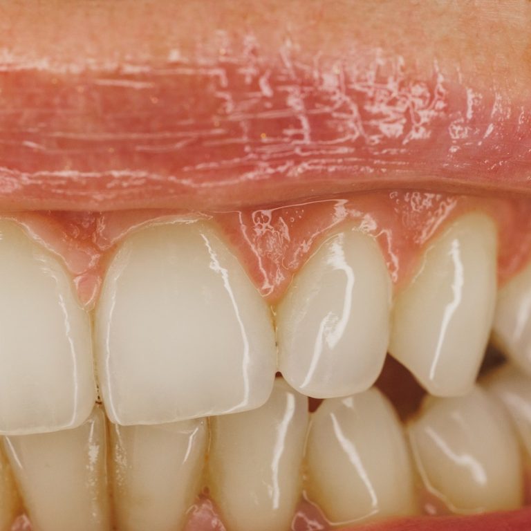 Shot of an unrecognisable woman smiling brightly with teeth before having orthodontist or dental work done.